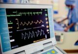 Ecg Machine