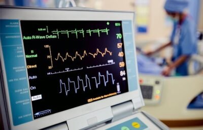 Ecg machine