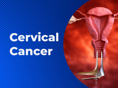 Cervical
