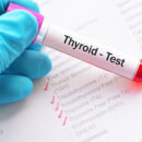 Thyroid Hormone Test