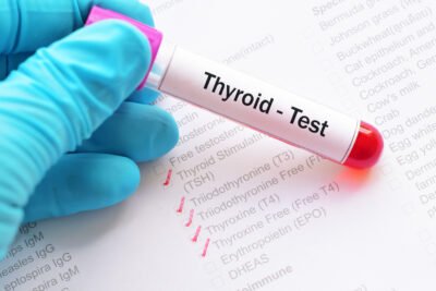 Thyroid Hormone Test