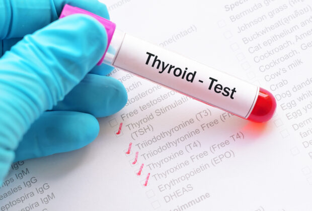Thyroid Hormone Test