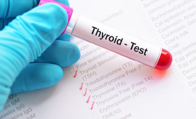 Thyroid Hormone Test