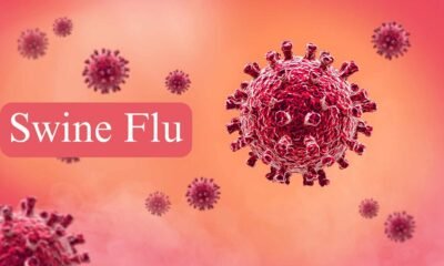 Swine flu