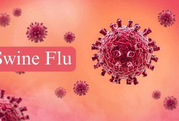 Swine flu